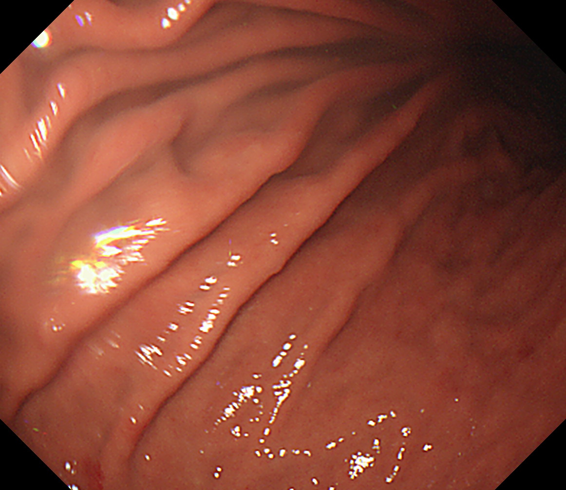 �̉������^